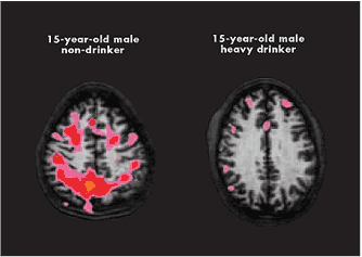 ComparisonTapertUCSD