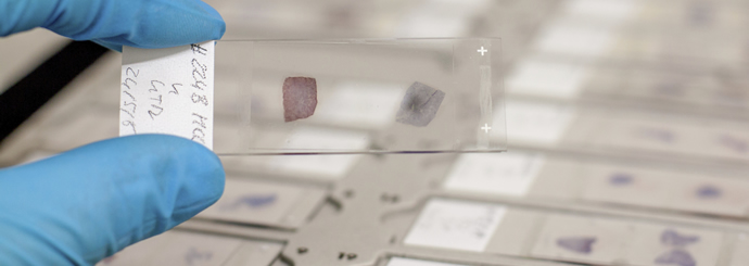 Knight Cancer Institute researcher studying lab specimen