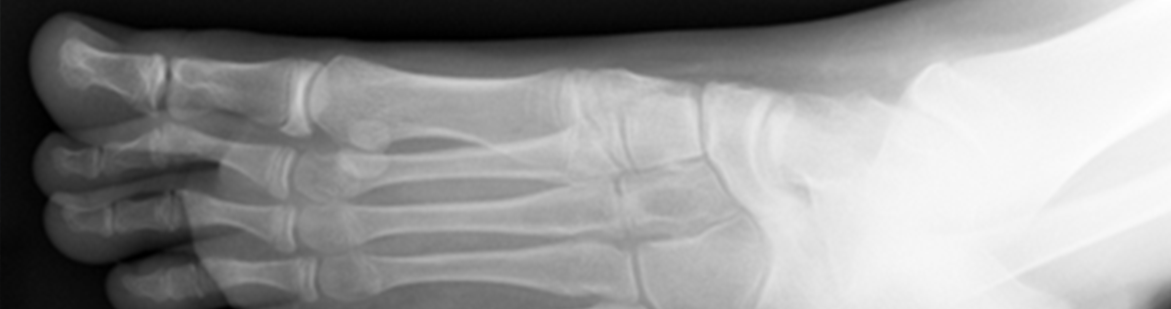 Foot Bone