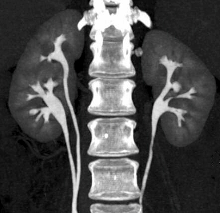 Duplex Kidney Imaging for Radiology