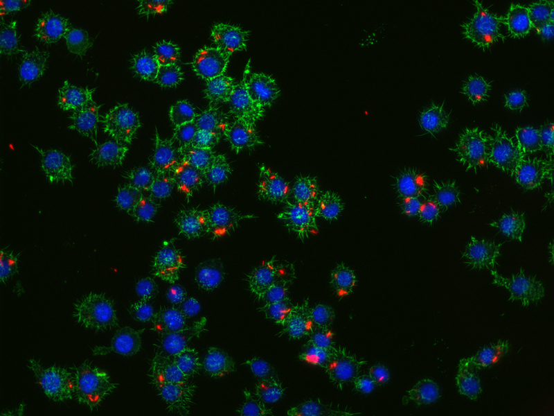 Mycobacterium tuberculosis bacteria that have infected mammalian macrophages.