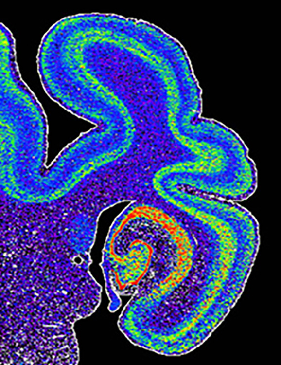 Glutamate receptor gene expression in the hippocampus