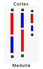 renal biopsy specimen divided
