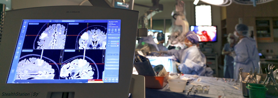 A monitor shows the progress of a tumor resection during an awake craniotomy. OHSU performs 40-50 of these procedures with language mapping each year.