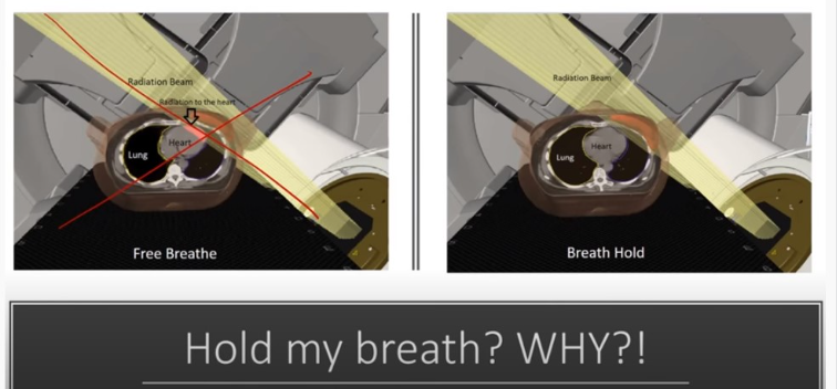 ABC breath hold senior capstone project.