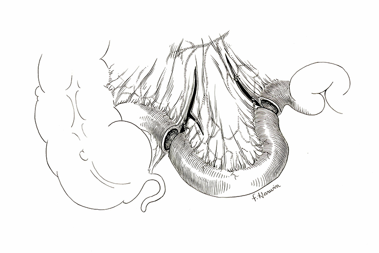 pen and ink drawing in the style of another OHSU medical illustrator Clarice Ashworth Francone