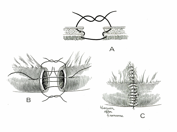 Pen and ink drawing in the style of another OHSU medical illustrator Clarice Ashworth Francone. 