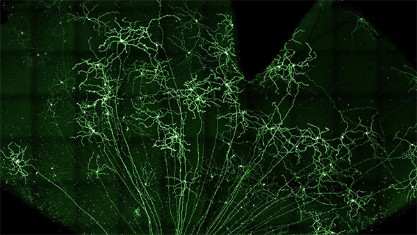 Image taken of glaucoma research from a microscope that looks like many green fireworks going off at once on a black background.