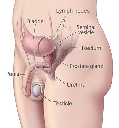 A drawing shows the location of the prostate gland in the body.