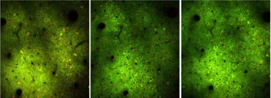 BEHN_brain_cells6c