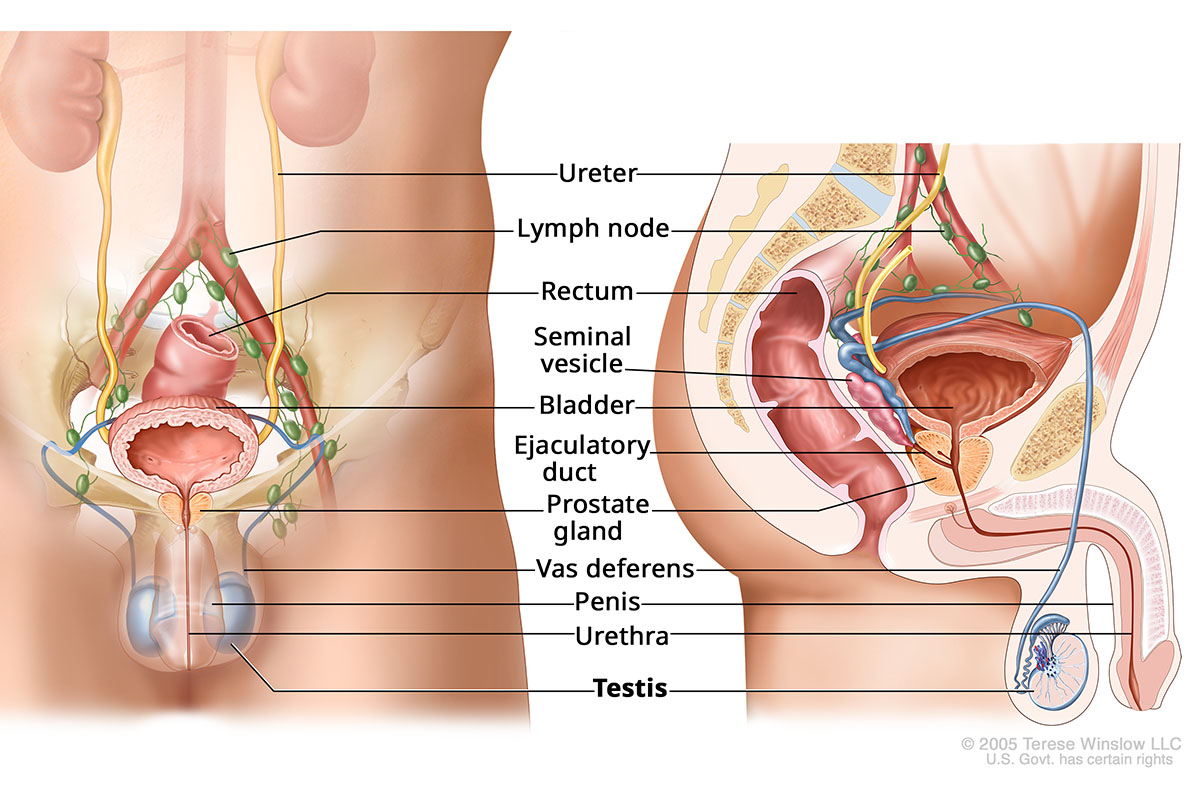 Medical illustration of male urogenital anatomy. Cancer in a testicle, or testis, affects a gland that makes and stores sperm. The two testicles also make testosterone.
